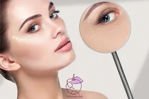 درمان چروک های زیر چشم