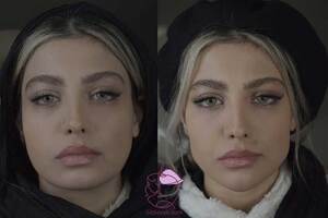 نمونه کار مادلینگ صورت - قبل و بعد
