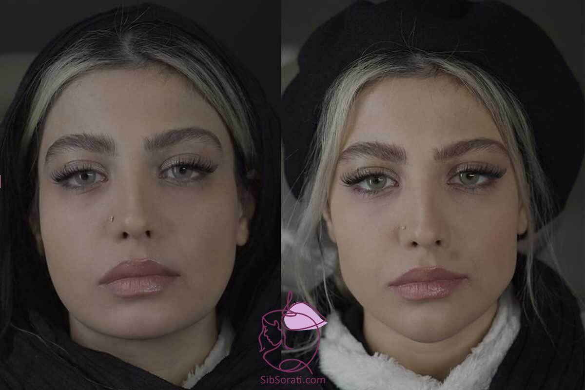 نمونه کار مادلینگ صورت - قبل و بعد نمونه کار مادلینگ صورت - قبل و بعد