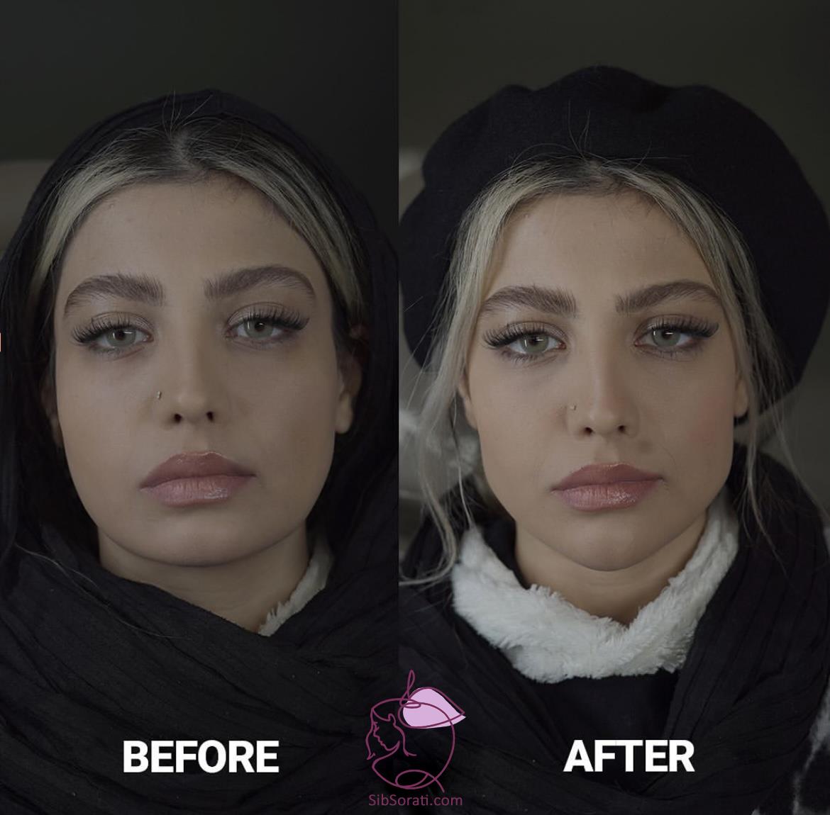 نمونه کار مادلینگ صورت قبل و بعد